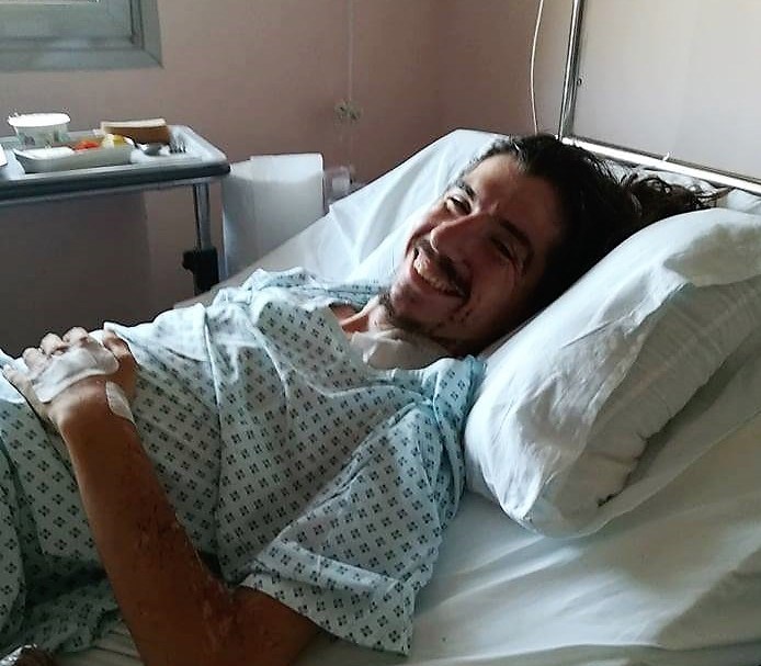 Ποδηλάτης της Δόξας Σταυρούπολης τραυματίστηκε σε πολύνεκρο δυστύχημα