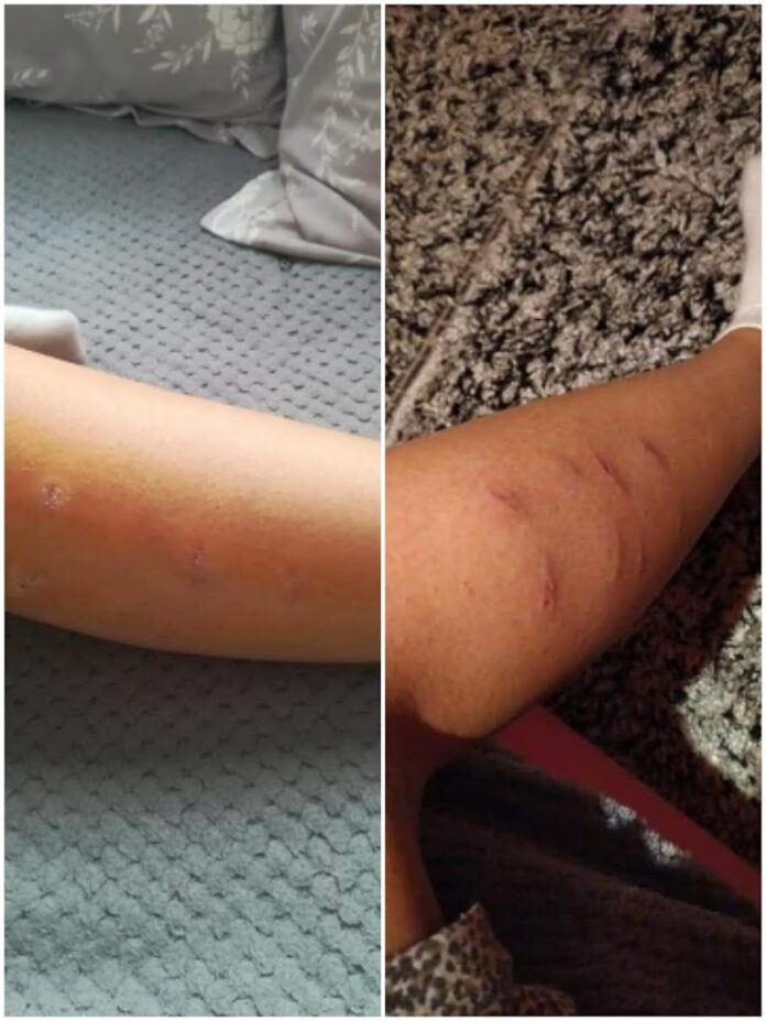 Ξάνθη: Στο Νοσοκομείο κοπέλα από επίθεση σκύλων