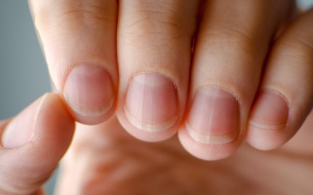 Πέντε ύπουλα προβλήματα υγείας που φαίνονται στα νύχια (ΔΕΙΤΕ ΕΙΚΟΝΕΣ)