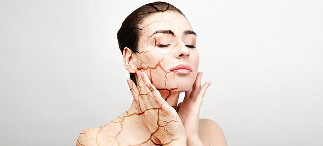 Δέρμα: Πώς να το προστατεύσετε από τα καλοκαιρινά εξανθήματα